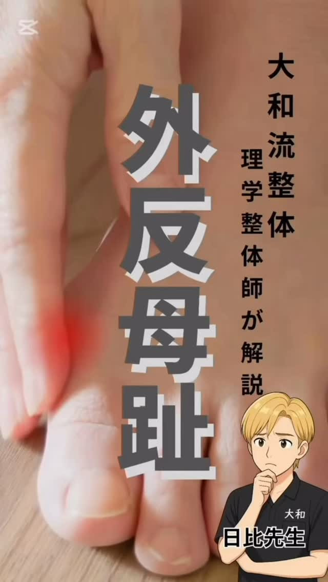 外反母趾のメカニズムを実際の施術場面で解説‼️